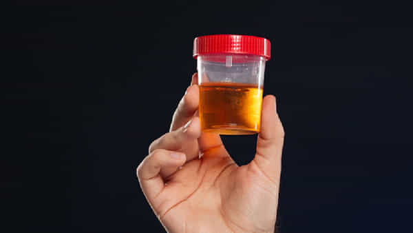 Urine Infection: తెల్లవారుజామున మూత్రం పసుపు రంగులో వస్తుందా..? అలా అయితే, అస్సలు ఆలస్యం చేయకండి..