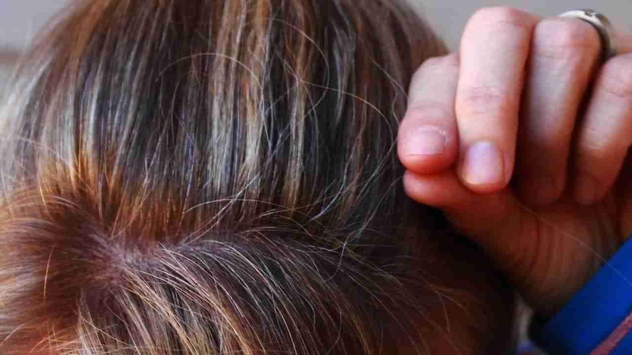 Hair Health: జుట్టు తెల్లబడడానికి కారణం ఏంటో తెలుసా.. నెరిసిపోయిన జుట్టును ఎందుకు లాగొద్దంటే..