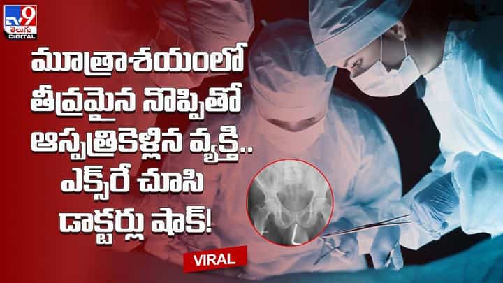 మూత్రాశయంలో తీవ్రమైన నొప్పితో అస్పత్రికెళ్లిన వ్యక్తి.. ఎక్స్రే చూసి డాక్టర్లు షాక్ !! మూత్రాశయంలో తీవ్రమైన నొప్పితో అస్పత్రికెళ్లిన వ్యక్తి.. ఎక్స్రే చూసి డాక్టర్లు షాక్ !!