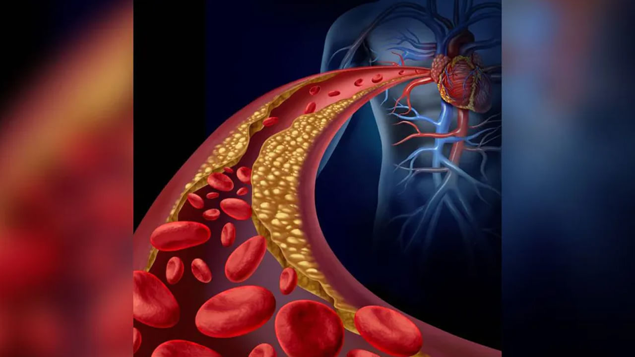 Bad Cholesterol: పది మంది భారతీయులలో ఆరుగురికి చెడు కొలెస్ట్రాల్.. పెరుగుతున్న గుండెపోటు కేసులు.. సర్వేలో షాకింగ్‌ నిజాలు