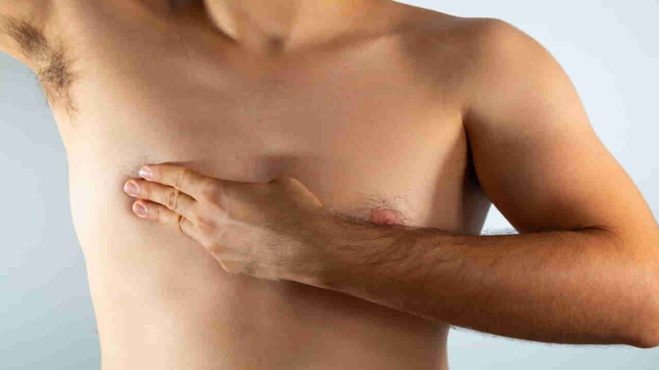 Breast Cancer In Men:పురుషుల్లో పెరుగుతున్న బ్రెస్ట్‌ క్యాన్సర్‌ కేసులు..! ఇలాంటి లక్షణాలను నిర్లక్ష్యం చెయొద్దు..