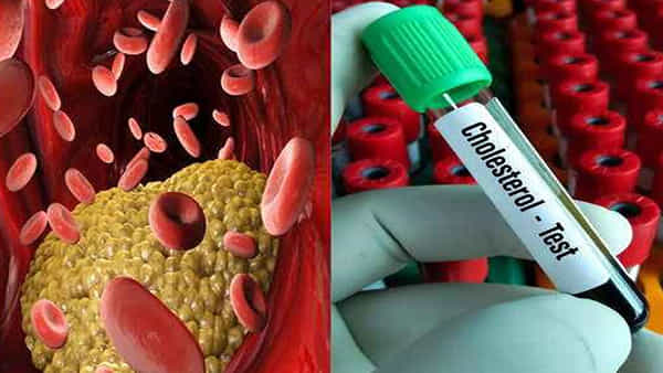 Cholesterol: ఆరోగ్యకరమైన వ్యక్తిలో కొలెస్ట్రాల్ ఎంత స్థాయిలో ఉండాలి.. ఎంత పెరిగితే ప్రమాదం.. పూర్తి వివరాలు మీకోసం..