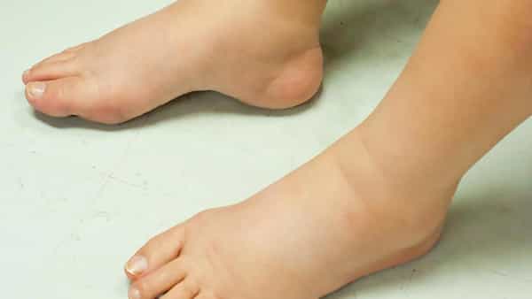 Health Tips: మీ పాదాల్లో వాపు వస్తుందా? అందుకు కారణాలు ఇవే కావొచ్చు..