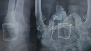 పన్నా గనుల్లో తవ్వకాలు జరుపుతుండగా కనిపించిన అనుకోని దృశ్యం.. ఏంటని చూడగా కళ్లు జిగేల్