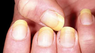 Diabetic Patients: రోజూ ఇన్సులిన్ తీసుకోవడం వల్ల క్యాన్సర్ వచ్చే ప్రమాదం.. మధుమేహ రోగులు జాగ్రత్త.. పరిశోధనలో షాకింగ్‌ విషయాలు