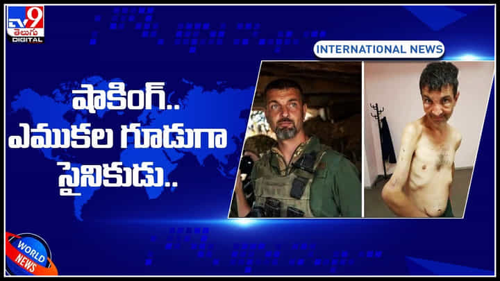 Ukraine Soldier: వామ్మో..! షాకింగ్.. సైనికుడి బిఫోర్ ఆఫ్టర్ ఫొటోలు.. జెనీవా ఒప్పందాలను కాలరాసిన రష్యా.. Ukraine Soldier: వామ్మో..! షాకింగ్.. సైనికుడి బిఫోర్ ఆఫ్టర్ ఫొటోలు.. జెనీవా ఒప్పందాలను కాలరాసిన రష్యా..