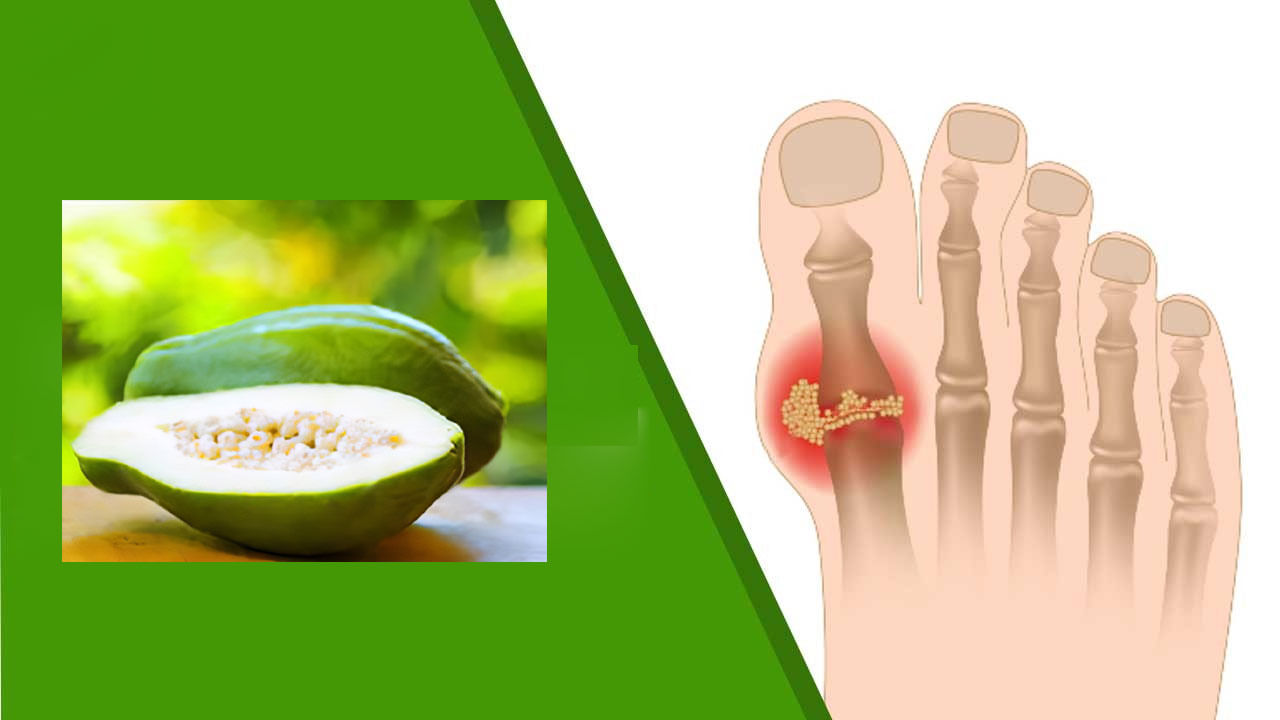 Uric Acid యూరిక్ యాసిడ్ సమస్యతో బాధపడుతున్నవారి ఈ పండు వరం.. ఎప్పుడు