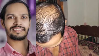 Lalu Yadav Kidney Transplant: అందుకే కంటే కూతురునే కనాలి అంటారు.. లాలూకు కిడ్నీ దానం చేయనున్న..