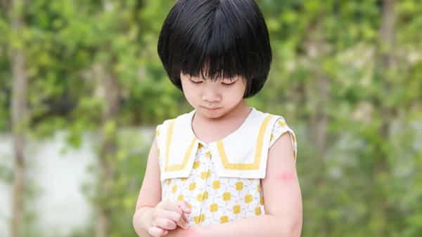 Child Care: మీ పిల్లల చర్మం పొడిబారిపోతోందా? మరేం దిగులు పడకండి.. ఈ టిప్స్తో సంరక్షించండి..