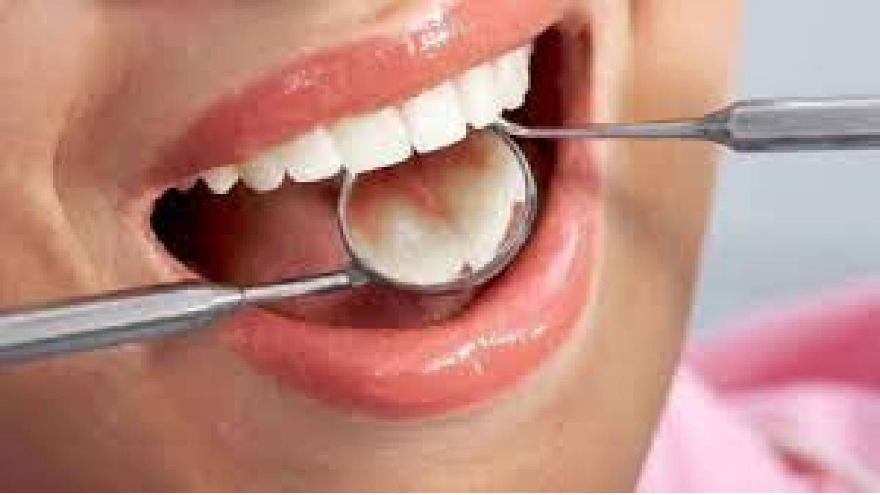 Dental Care: వీటిని తింటే దంతాల ఆరోగ్యం డేంజర్లో పడినట్లే.. వెంటనే దూరం పెట్టాల్సిందే