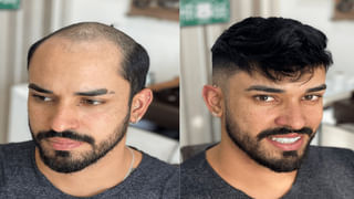 Millets: బియ్యం గోధుమలతో పోలిస్తే మిల్లెట్లు ఎందుకు ఆరోగ్యకరం.. నిపుణులు ఏం చెబుతున్నారో తెలుసా..