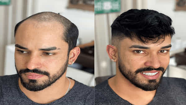 Hair Growth Foods: ఊడిన చోట జుట్టు మళ్లీ రావాలంటే.. ఈ గింజలను తింటే సరి..