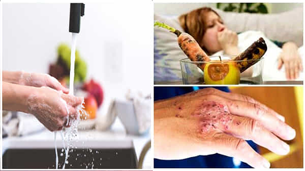 Hand Washing: కోవిడ్ లేదని చేతులు కడగడం మానేస్తున్నారా.. జాగ్రత్త! మీరు చిన్న పొరపాటు చేస్తే ఈ బ్యాక్టీరియా మిమ్మల్ని నమిలేస్తుంది..