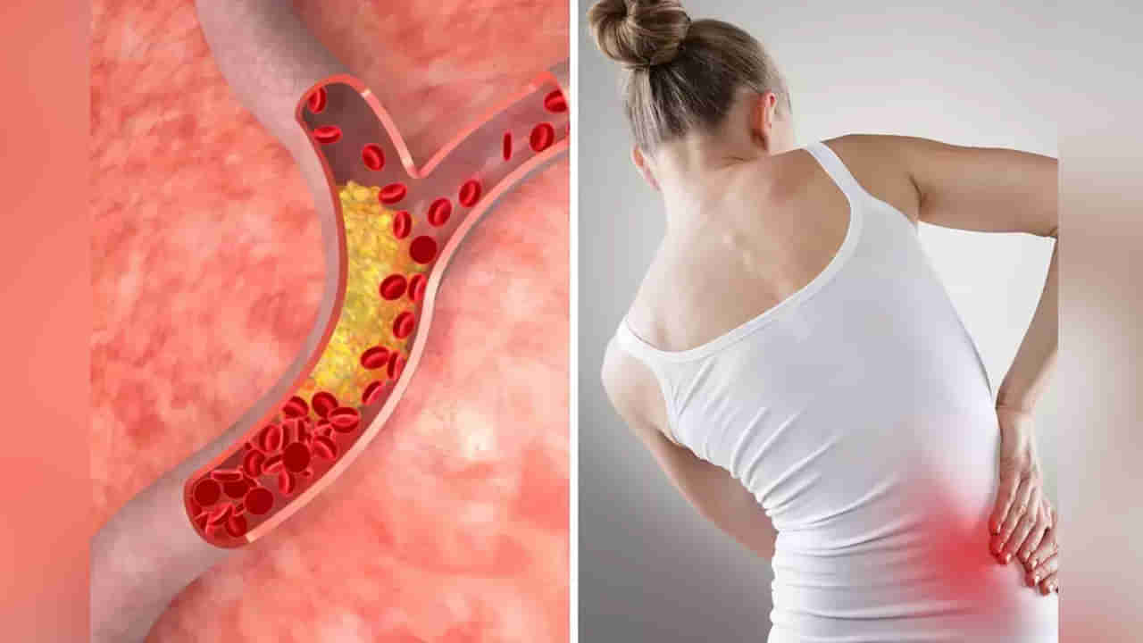 Health: ఈ లక్షణాలతో బాధపడుతున్నారా.? అయితే మీలో కొలెస్ట్రాల్ పెరిగినట్లే.. వెంటనే అలర్ట్‌ అవ్వండి..