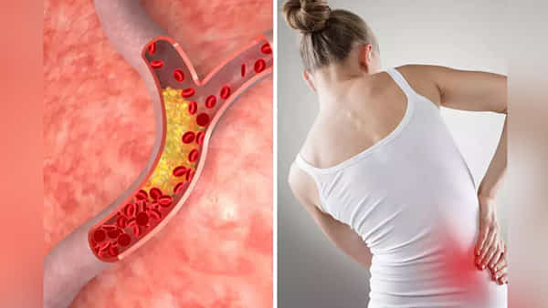 Health: ఈ లక్షణాలతో బాధపడుతున్నారా.? అయితే మీలో కొలెస్ట్రాల్ పెరిగినట్లే.. వెంటనే అలర్ట్ అవ్వండి..