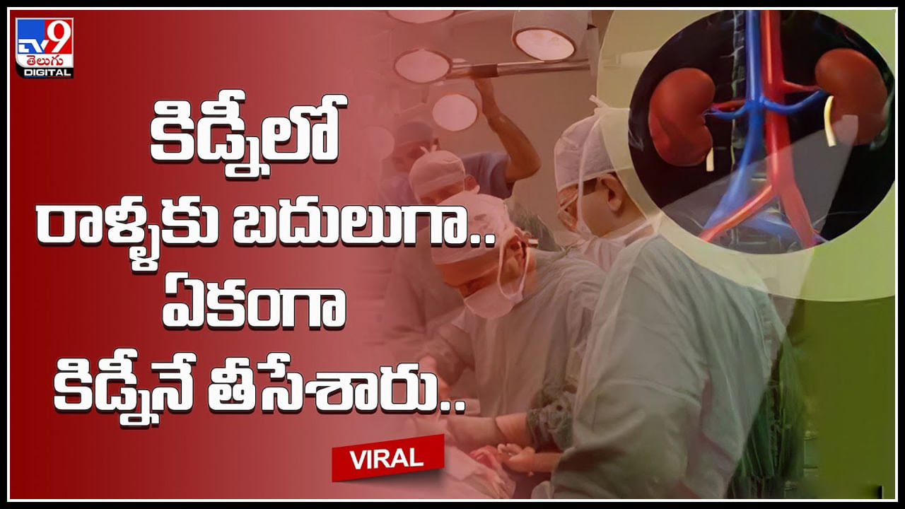 Kidney Viral Video: వీడెక్కడి డాక్టర్ అండి బాబు.. కిడ్నీలో రాళ్ళకు బదులుగా.. ఏకంగా కిడ్నీనే తీసేశారు..