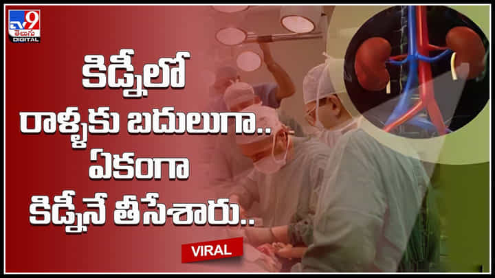 Kidney Viral Video: వీడెక్కడి డాక్టర్ అండి బాబు.. కిడ్నీలో రాళ్ళకు బదులుగా.. ఏకంగా కిడ్నీనే తీసేశారు.. Kidney Viral Video: వీడెక్కడి డాక్టర్ అండి బాబు.. కిడ్నీలో రాళ్ళకు బదులుగా.. ఏకంగా కిడ్నీనే తీసేశారు..