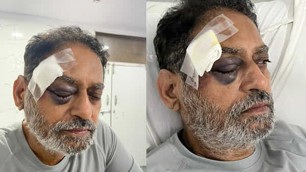Hyderabad: రాహుల్ జోడో యాత్రలో తోపులాట.. మాజీ మంత్రికి తీవ్రగాయాలు.. ఆస్పత్రికి తరలింపు