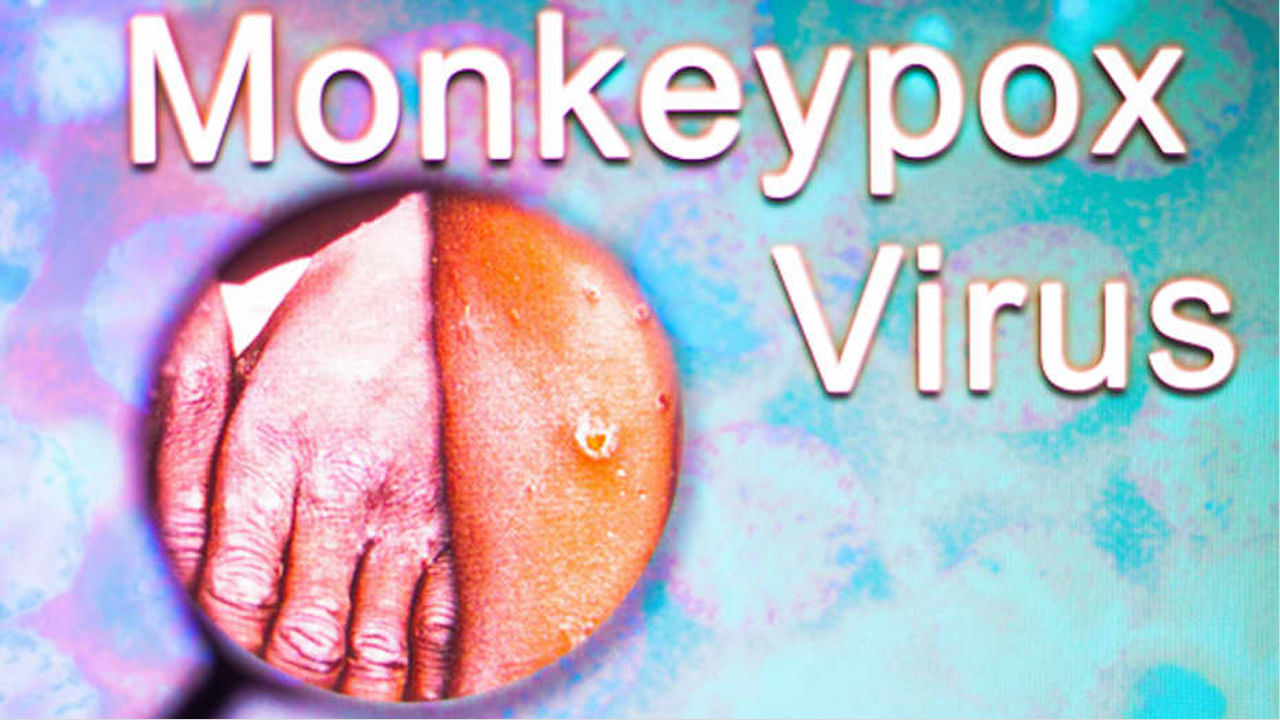 Monkeypox Virus: జంతువుల నుంచి మనుషులకు వ్యాపించే ఆ వైరస్‌ పేరు  మార్చిన ప్రపంచ ఆరోగ్య సంస్థ.. కారణాలేమిటంటే..?