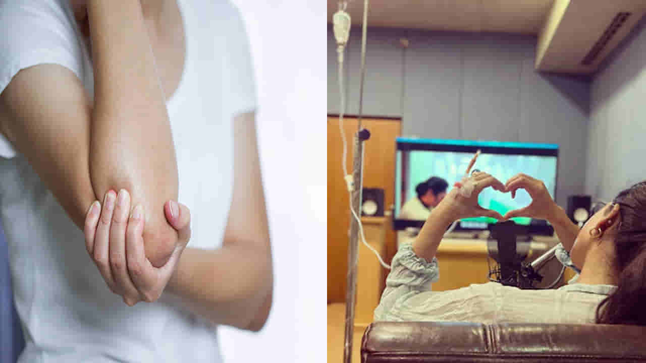 Myositis: సమంతకొచ్చిన అరుదైన వ్యాధికి డైట్‌తో చెక్‌ పెట్టలేమా.? వైద్య నిపుణులు ఏమంటున్నారంటే..