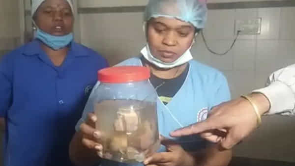 Viral: నవజాత శిశువుకు ఉబ్బిన పొట్ట.. డాక్టర్లు స్కాన్ చేసి రిపోర్ట్స్ చూడగా.. ప్రపంచంలోనే ఇదే మొదటిసారి..
