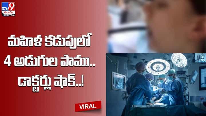 Viral: మహిళ కడుపులో 4 అడుగుల పాము !! డాక్టర్లు షాక్ !! Viral: మహిళ కడుపులో 4 అడుగుల పాము !! డాక్టర్లు షాక్ !!