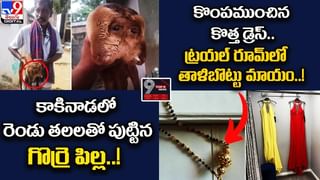 Viral: మహిళ కడుపులో 4 అడుగుల పాము !! డాక్టర్లు షాక్‌ !!