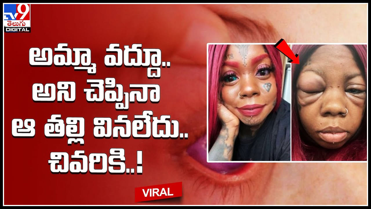 Women Tattoo: అమ్మా వద్దూ.. అని చెప్పినా ఆ తల్లి వినలేదు.. చివరికి..! కనులు గుడ్లు వాచిపోయి పూర్తిగా..