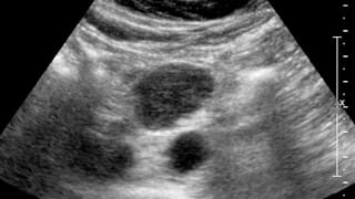 Covid-19 Emergency: కోవిడ్‌పై కేంద్రం అలెర్ట్.. మంగళవారం అన్ని రాష్ట్రాల్లో మాక్ డ్రిల్..