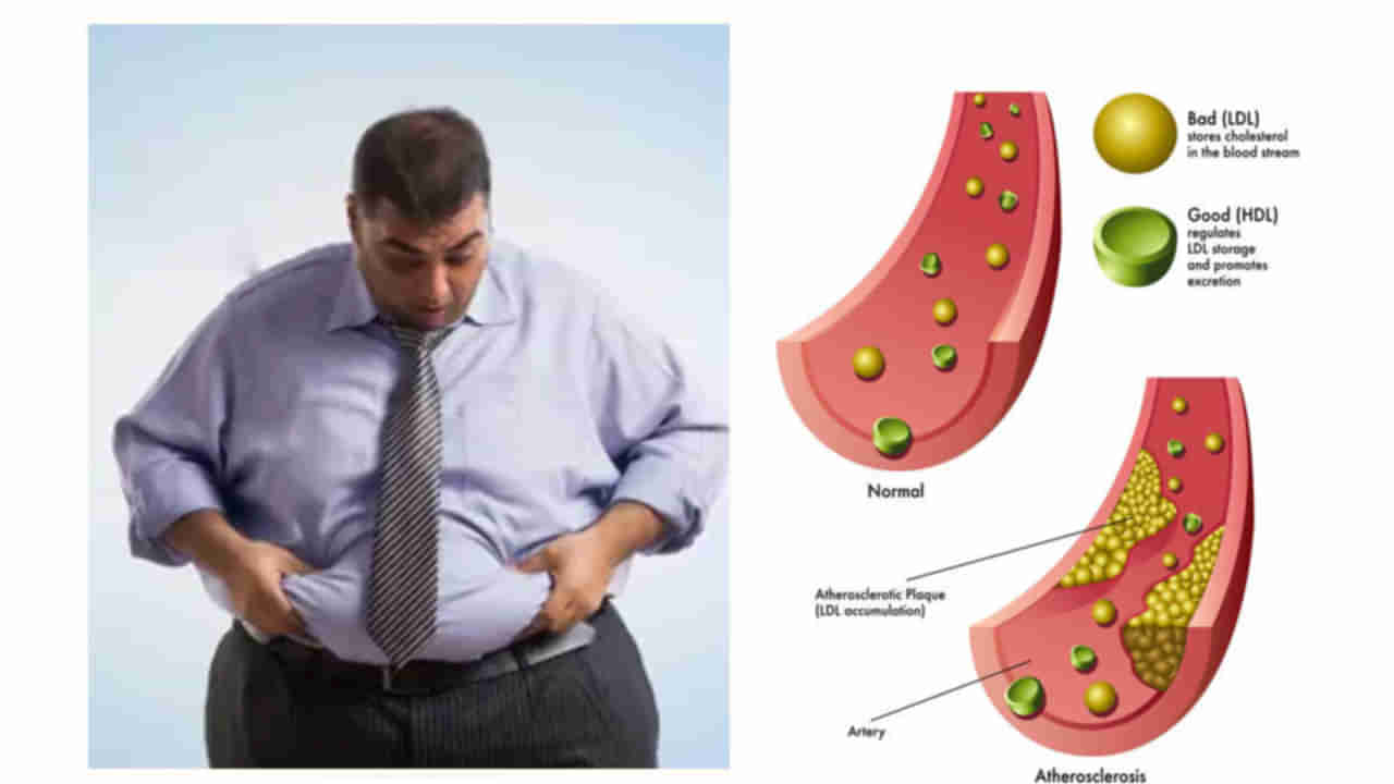 High Cholesterol Symptoms: మీ కాలు, చేతుల వేళ్లల్లో ఈ లక్షణాలు కనిపిస్తున్నాయా? అయితే మీరు అధిక కొలెస్ట్రాల్‌ సమస్యతో బాధపడుతున్నట్టే..!