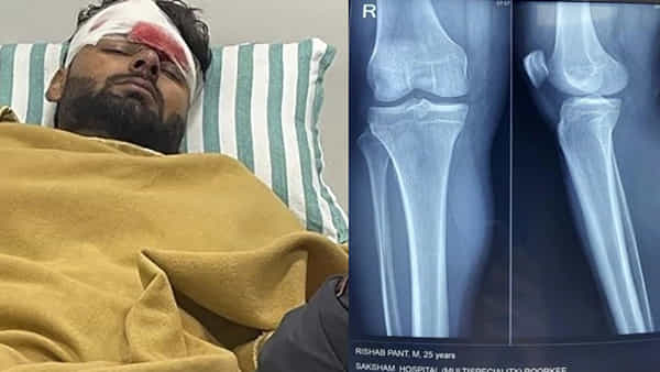 Rishabh Pant accident: పంత్ ప్రజంట్ సిట్యువేషన్ ఇది.. డిస్ లొకేట్ అయిన కుడి మోకాలి లిగ్మెంట్