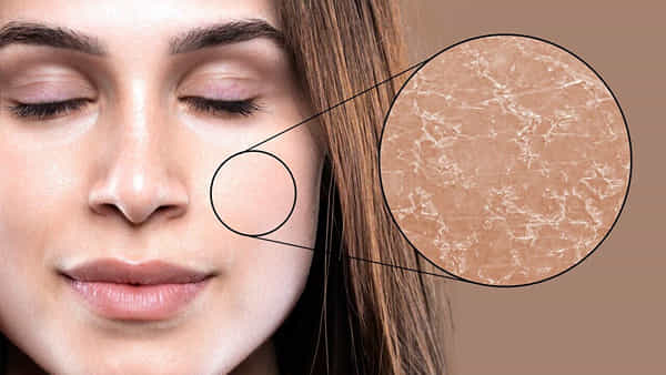 Skincare Tips: పొడిబారిన చర్మంతో ఇబ్బందిపడుతున్నారా..? అయితే మీ కోసం నిపుణులు ఏం చెబుతున్నారో తెలుసుకోండి..