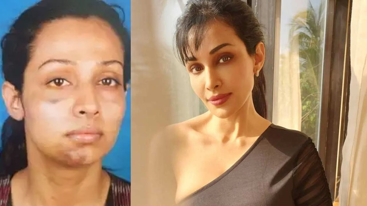 Flora Saini : అతని చేతుల్లో చావు దెబ్బలు తిన్నాను.. షాకింగ్ విషయాలు చెప్పిన హీరోయిన్