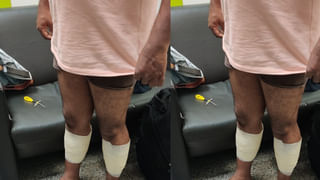 Hyderabad: సంచలనంగా మారిన ఇందు మరణం మిస్టరీ.. పోస్ట్‌మార్టం రిపోర్ట్‌లోని అంశాలివే