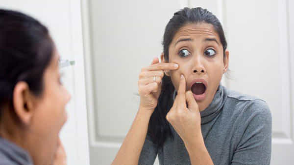 Acne and Pimples: మీరు మొటిమలతో బాధపడుతున్నారా..? అయితే ఈ విధంగా వాటికి పరిష్కరించుకోండి..