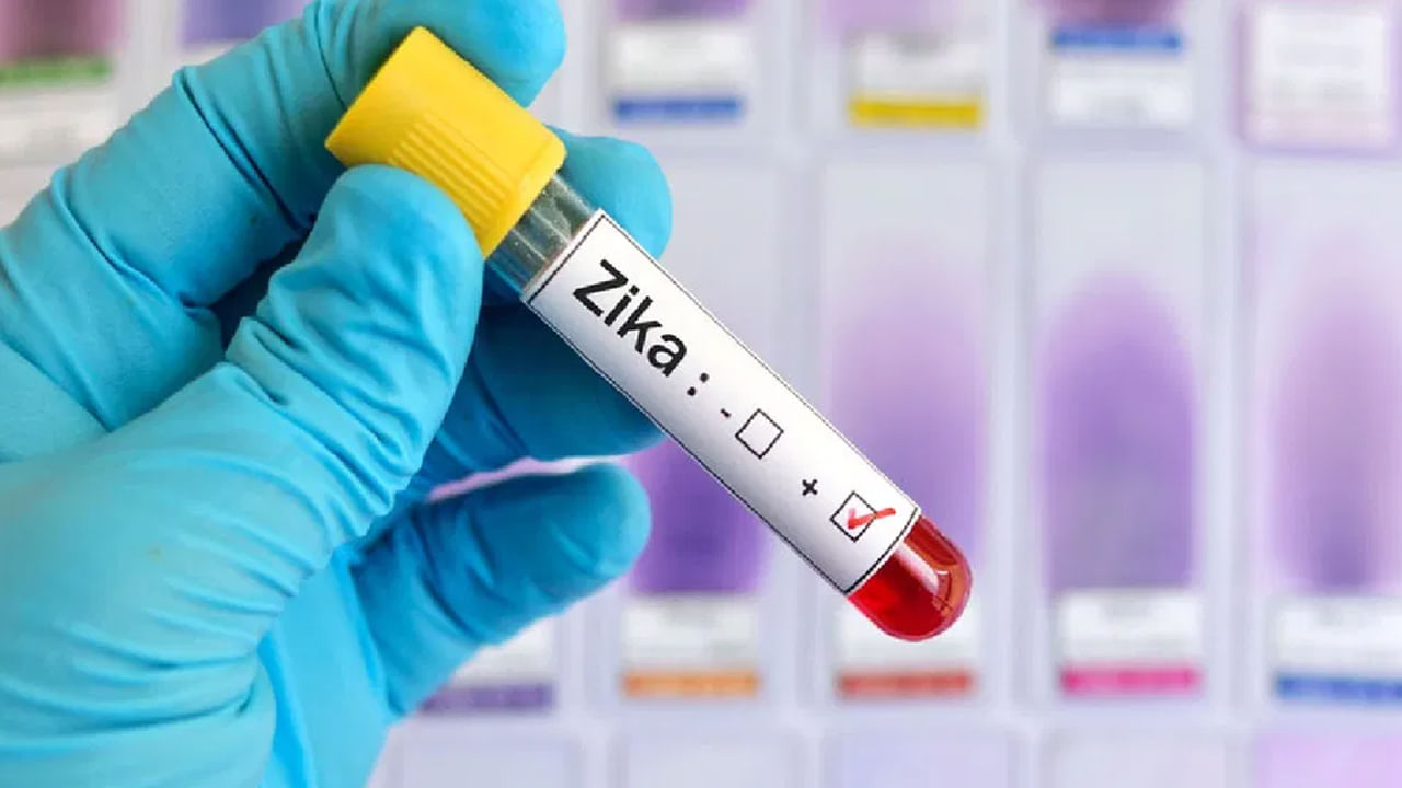 Zika Virus: జికా వైరస్- డెంగ్యూ-మలేరియా లక్షణాల మధ్య తేడా తెలుసుకోవటం చాలా ముఖ్యం.. లేదంటే, ఇబ్బంది పడాల్సిందే..!