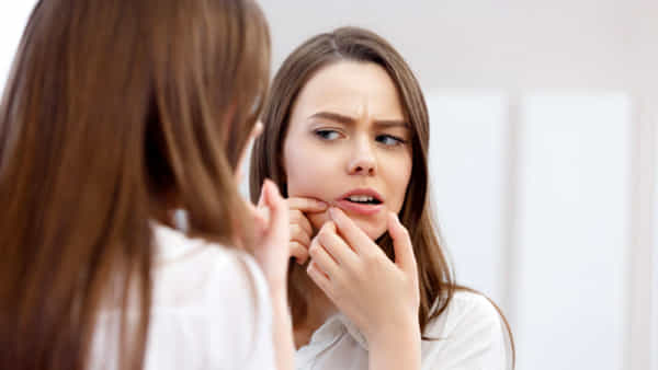 Skin care Tips: మొటిమలతో ముఖం చూపించలేకపోతున్నారా? ఇవి ట్రై చేయండి.. సహజ సౌందర్యం మీ సొంతం..