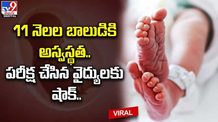 11 నెలల బాలుడికి అస్వస్థత.. పరీక్ష చేసిన వైద్యులకు షాక్ !! 11 నెలల బాలుడికి అస్వస్థత.. పరీక్ష చేసిన వైద్యులకు షాక్ !!