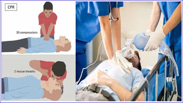 CPR అంటే ఏమిటి..? గుండెపోటుకు గురైన వ్యక్తికి సీపీఆర్ విధానంతో బతికించవచ్చా..?