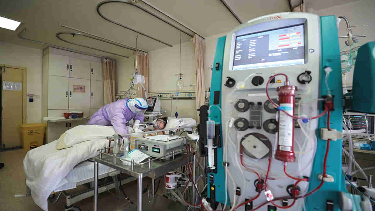 What is ECMO: ఎక్మో అంటే ఏంటి.. ఏ పరిస్థితుల్లో ఈ వైద్యం అందిస్తారు.. ఎలా ట్రీట్మెంట్ చేస్తారు..?