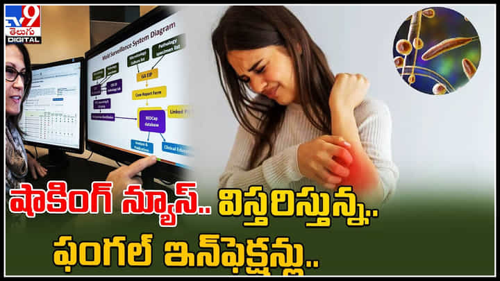 Fungal Disease: షాకింగ్ న్యూస్.. విస్తరిస్తున్న.. ఫంగల్ ఇన్ఫెక్షన్లు , లక్షణాలు.. పూర్తి వివరాలు.. వీడియో. Fungal Disease: షాకింగ్ న్యూస్.. విస్తరిస్తున్న.. ఫంగల్ ఇన్ఫెక్షన్లు , లక్షణాలు.. పూర్తి వివరాలు.. వీడియో.