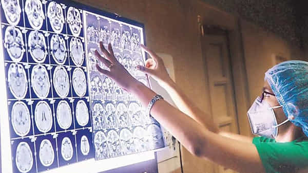 Fungal Disease: భారతీయుల ఆరోగ్యంపై ఆందోళనకర అధ్యయనం.. 5.72 కోట్ల మందిలో తీవ్రమైన ఫంగల్ వ్యాధి
