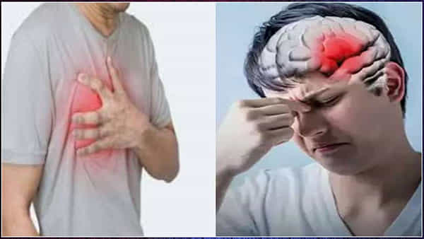 Heart Attack, Brain Stroke: చలికాలంలో బ్రెయిన్ స్ట్రోక్, గుండెపోటు ఎందుకు వస్తుంది..? ప్రారంభ లక్షణాలు ఏమిటి?
