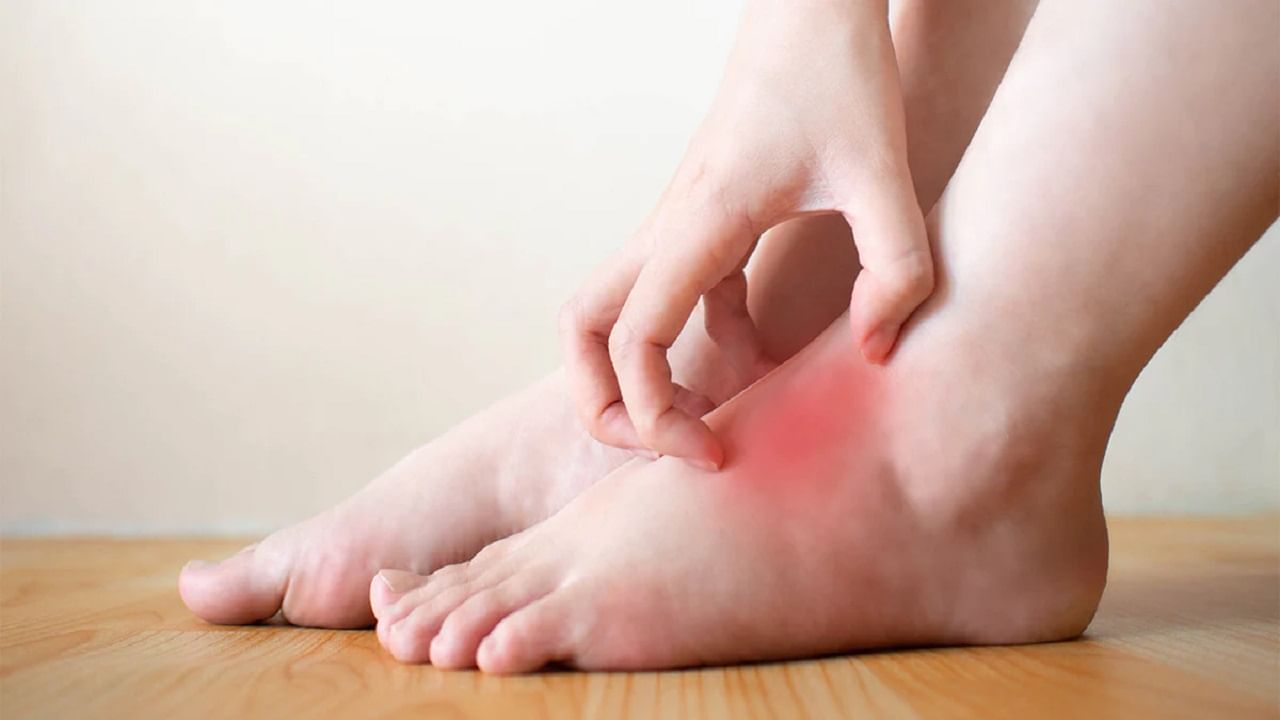 ఇన్ ఫ్లమేషన్ అంటే ఏంటి..ఇది శరీరాన్ని రోగం వైపు ఎలా నడిపిస్తుంది..రాకుండా ఏం చేయాలి..