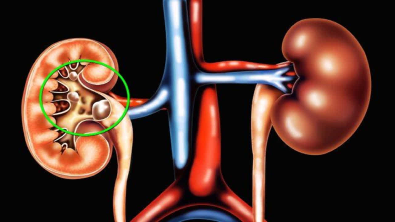 Kidney