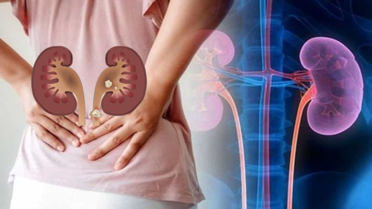 Kidneys