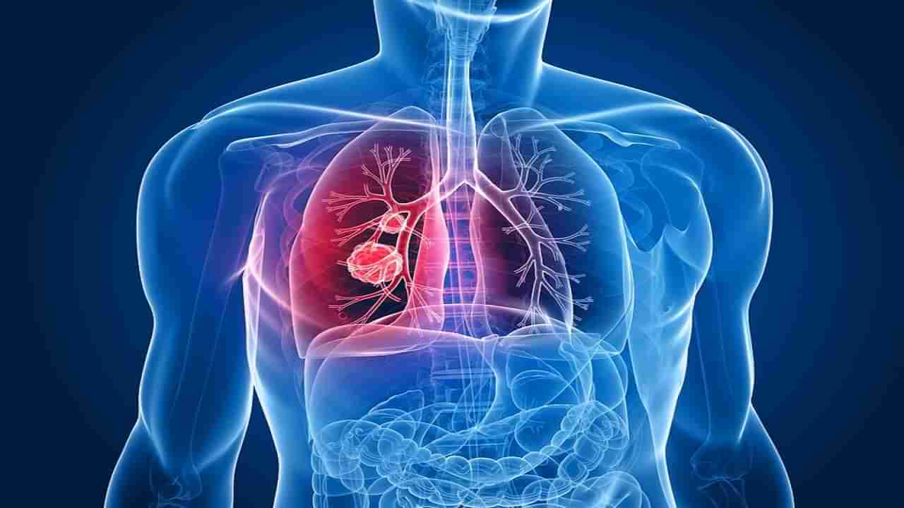 Lung Cancer: వామ్మో.. సిగరెట్ తాగకపోయినా లంగ్స్ క్యాన్సర్ వస్తుందట..! తాజా పరిశోధనలో సంచలన విషయాలు..