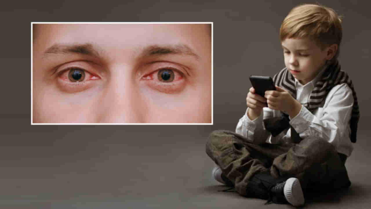 Mobile Phone: మొబైల్ ఫోన్ ఎక్కువగా వాడటం వల్ల కళ్లలో నీళ్లు వస్తాయా?.. ఇలా ఎందుకు జరుగుతుందో తెలుసా..