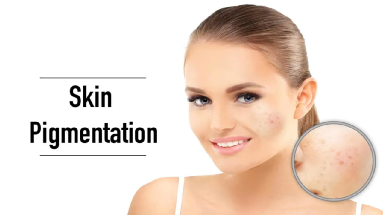 Pigmentation 
