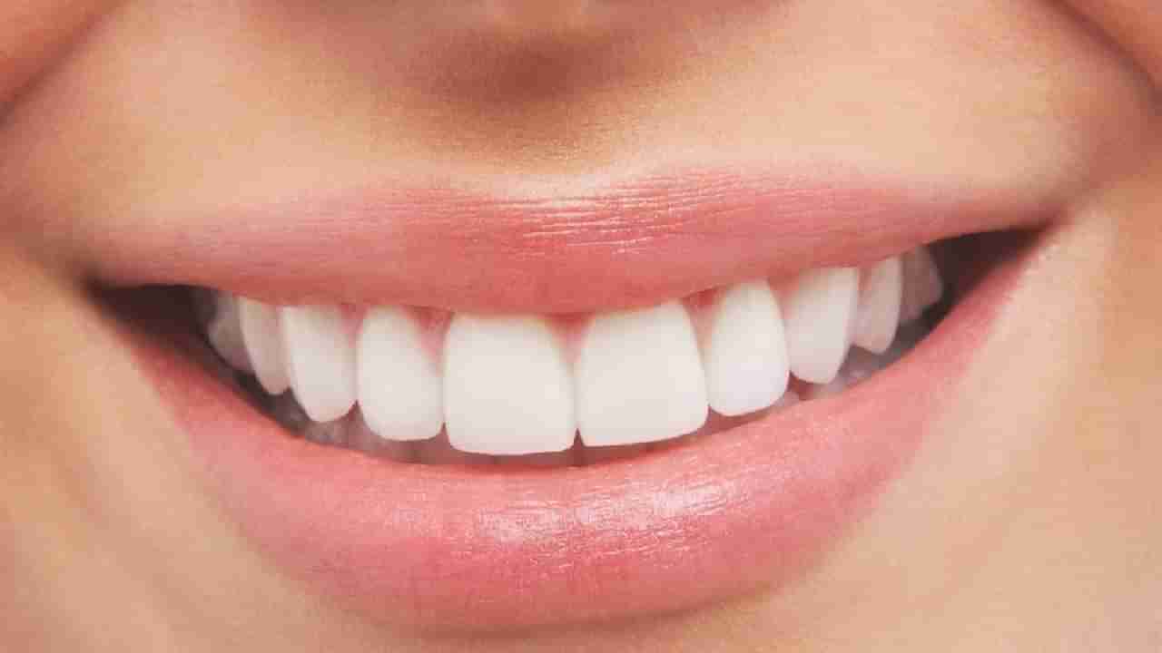 Dental care: దంతాలు రంగు మారుతున్నాయా.. ఎన్ని పేస్ట్‌లు వాడినా ఫలితం లేదా.. ఈ చిట్కాలు మీకోసం..